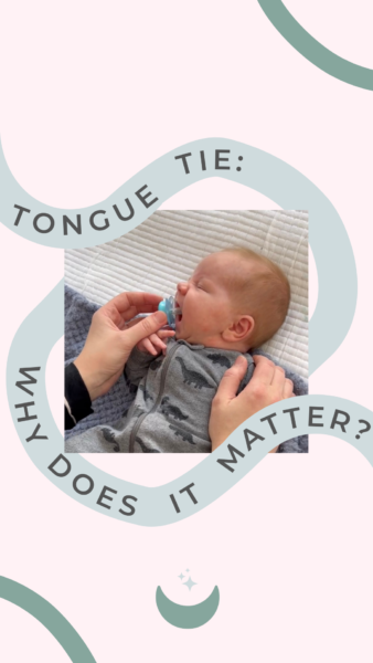 Tongue Tie | The Peaceful Sleeper